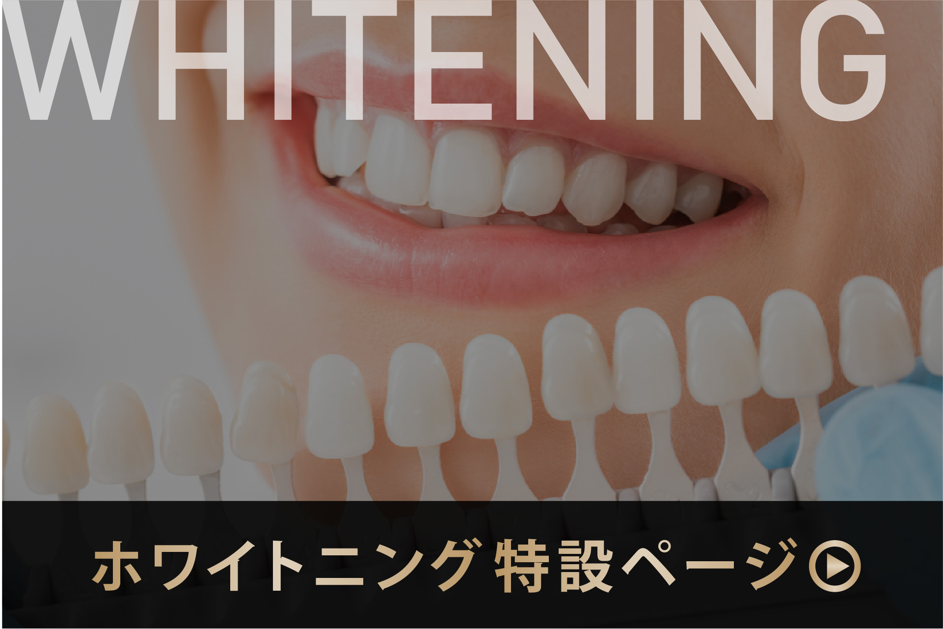 ホワイトニング